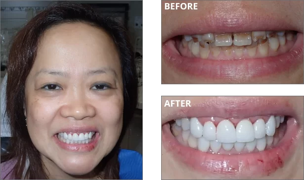 cosmetic-before-after-01