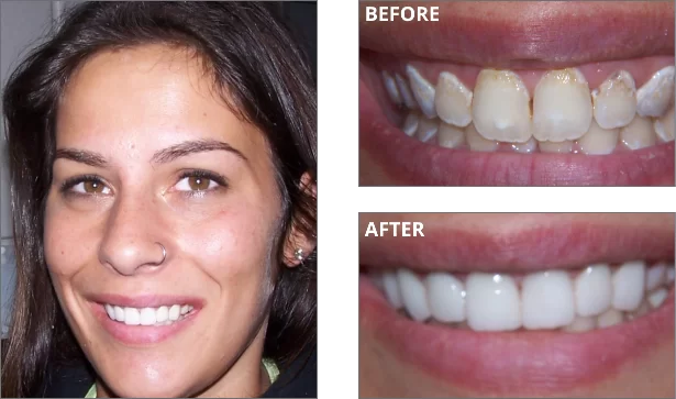 cosmetic-before-after-02