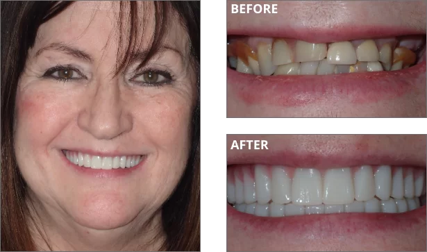 welcome-before-after-01