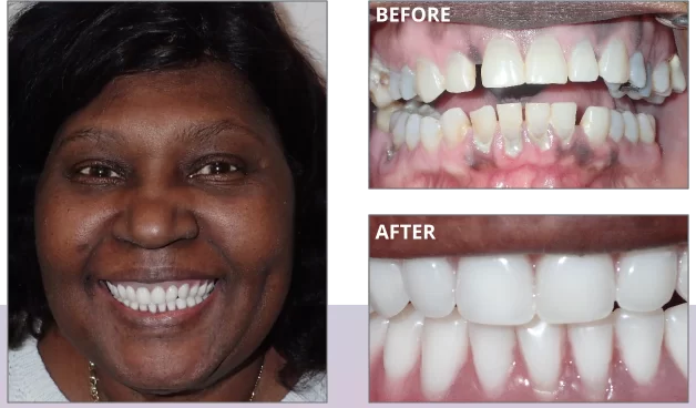 welcome-before-after-03