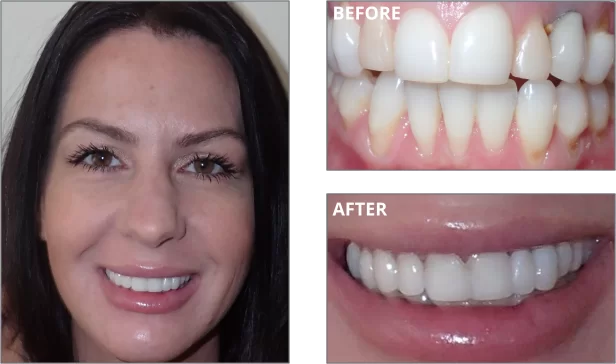 welcome-before-after-04